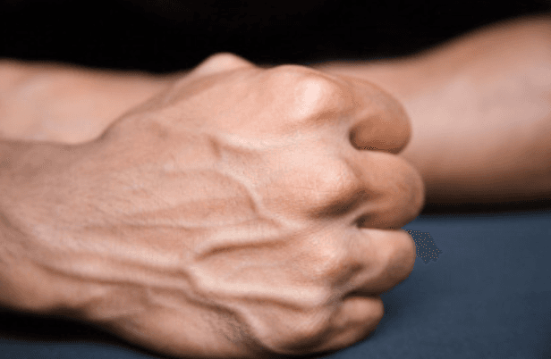 Image for Cracking your knuckles causes arthritis